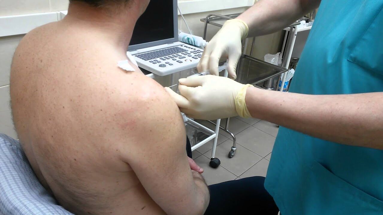 injection in the shoulder with osteoarthritis