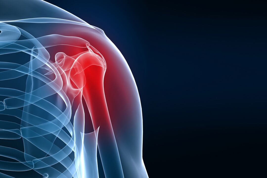shoulder osteoarthritis